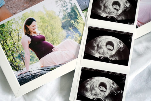 Rückblick auf meine Schwangerschaft + Babybauch Shooting
